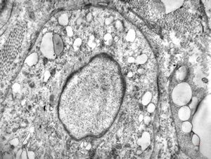 M,2y. | myopathy - regenerating muscle cell M,2y. | myopathy - regenerating muscle cell